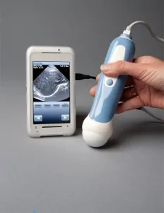 Need an Ultrasound? There's an App for that! - slide1 1 lg