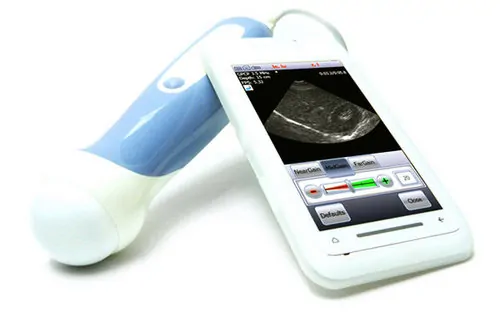 ultrasound app for smartphone