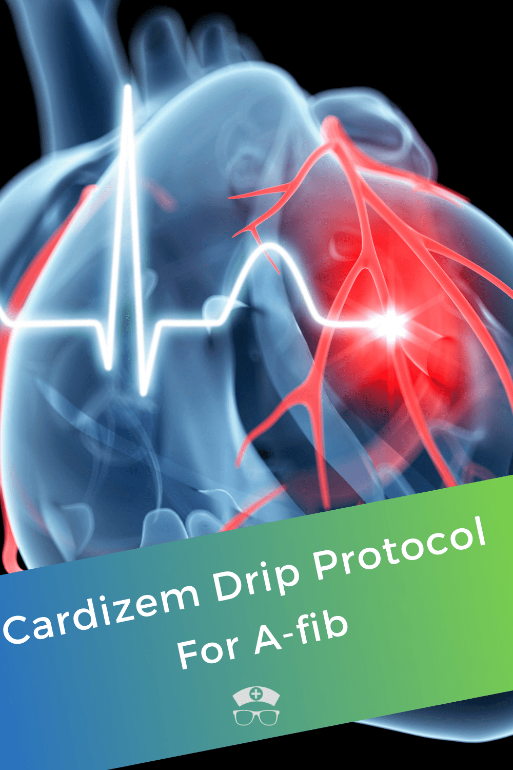 Cardizem Drip Protocol For A-fib