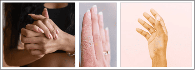 Hand Skin Problems